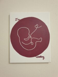 Baby bump